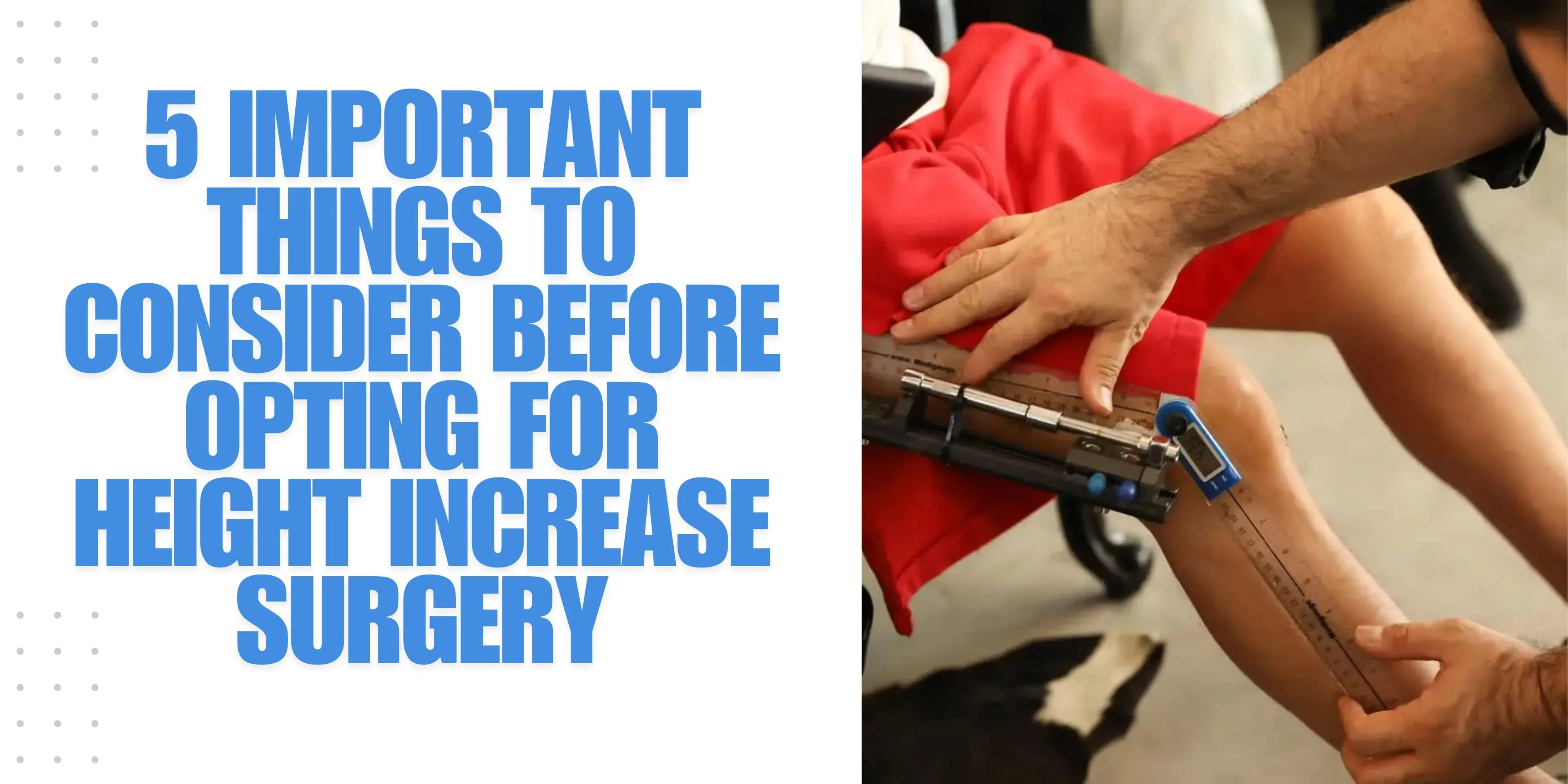 Limb Lengthening in India