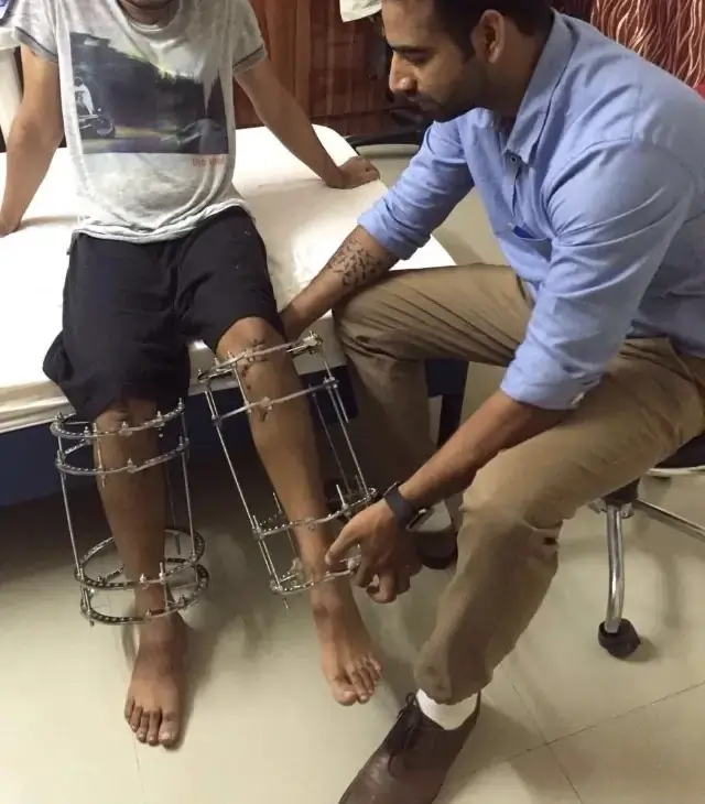 Limb Lengthening in India