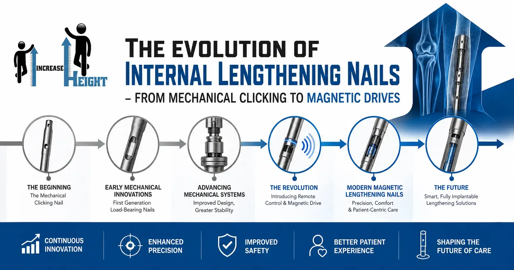 Evolution of Internal Lengthening Nails