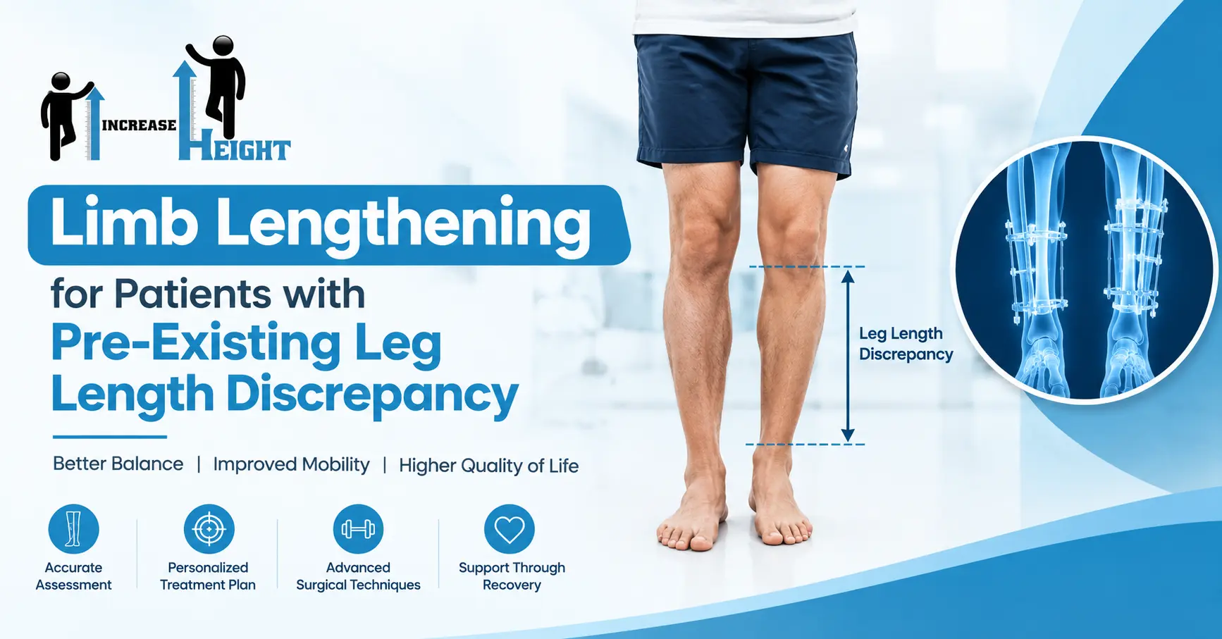 Limb lengthening for patients with leg length discrepancy