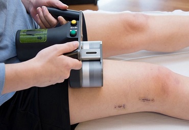 Limb Lengthening in India